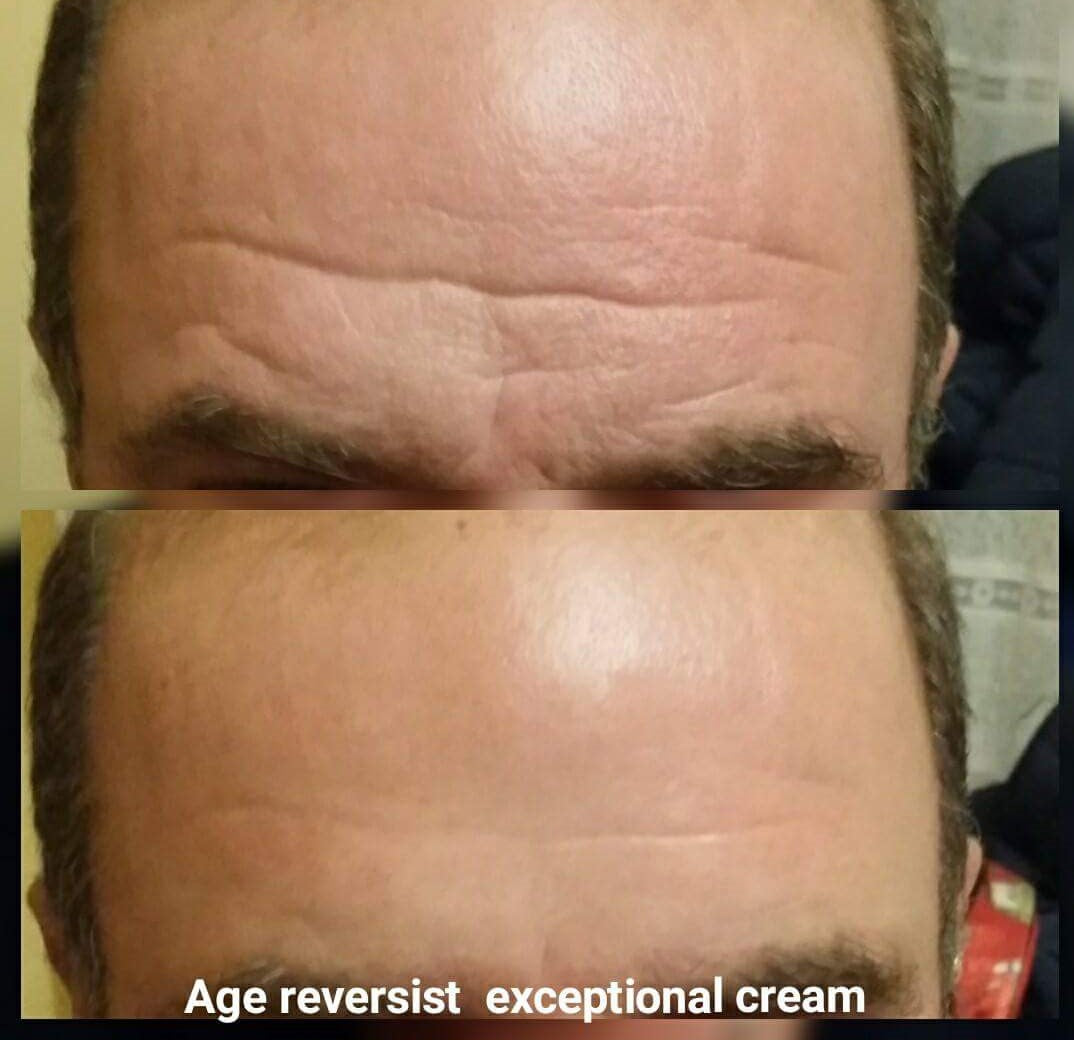 Exceptional Cream Results